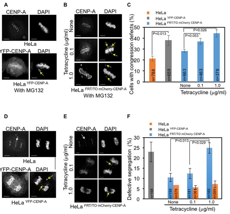 https://cdn.ncbi.nlm.nih.gov/pmc/blobs/7975/5564523/6985c93edc0c/oncotarget-08-46781-g002.jpg