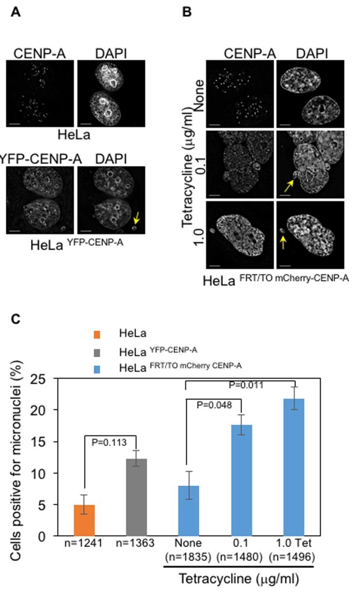 https://cdn.ncbi.nlm.nih.gov/pmc/blobs/7975/5564523/f90c61155d25/oncotarget-08-46781-g003.jpg