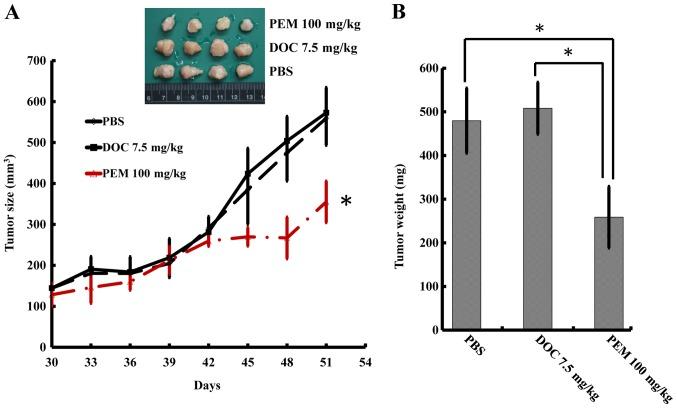 https://cdn.ncbi.nlm.nih.gov/pmc/blobs/7987/5780031/bb2c19526cc8/OR-38-05-2787-g03.jpg
