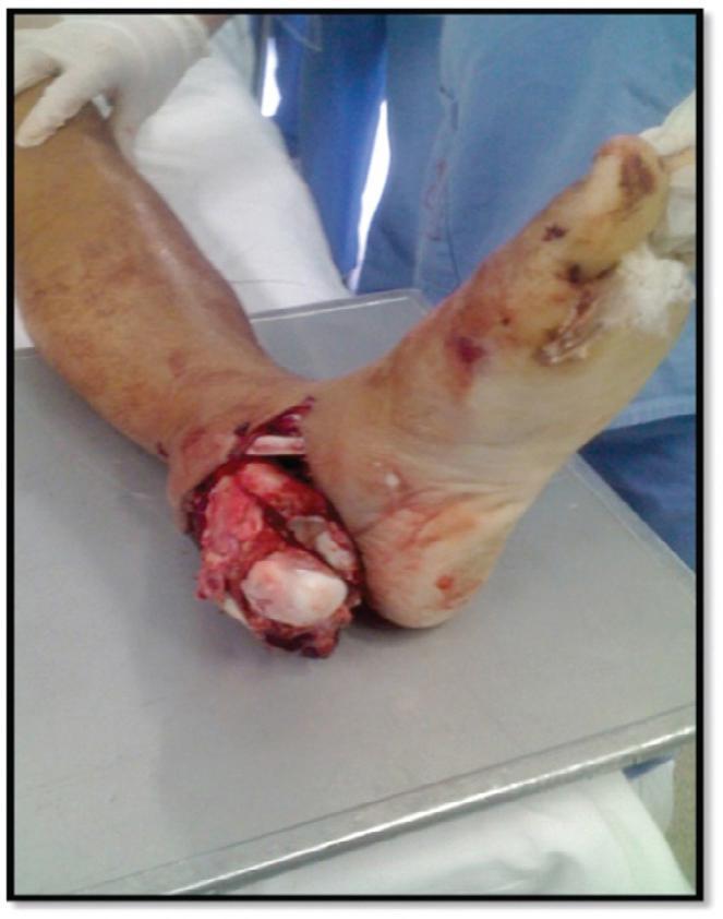 https://cdn.ncbi.nlm.nih.gov/pmc/blobs/7987/6565860/c14c385b2853/gr1.jpg