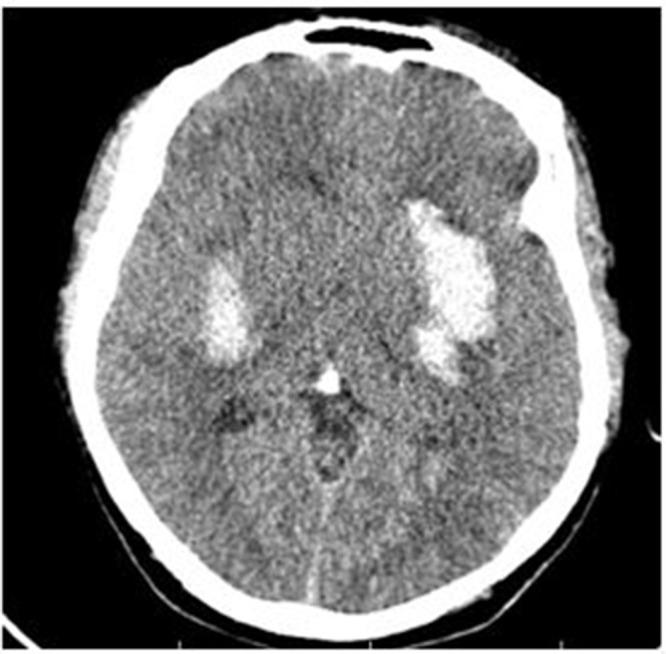 https://cdn.ncbi.nlm.nih.gov/pmc/blobs/798b/9271278/37c0e4930402/VHRM-18-473-g0001.jpg