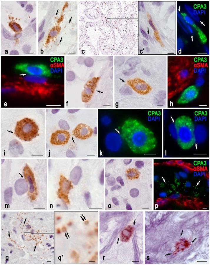 https://cdn.ncbi.nlm.nih.gov/pmc/blobs/7995/11120214/8a7f65dc3424/cells-13-00833-g003.jpg