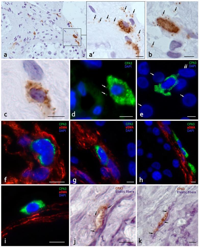 https://cdn.ncbi.nlm.nih.gov/pmc/blobs/7995/11120214/bd737f53e1b3/cells-13-00833-g004.jpg