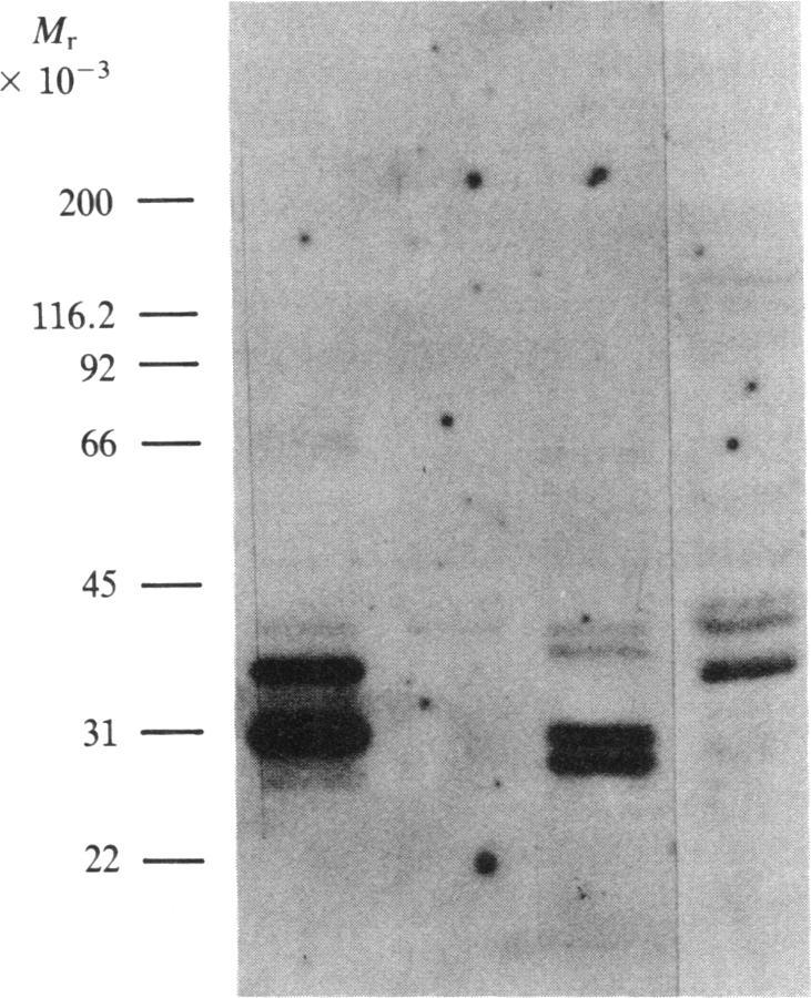 https://cdn.ncbi.nlm.nih.gov/pmc/blobs/799e/397262/9103df325d08/pnas00345-0079-c.jpg