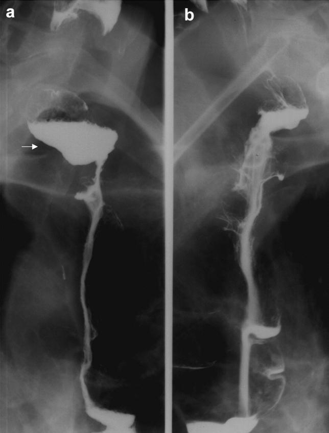 https://cdn.ncbi.nlm.nih.gov/pmc/blobs/79b5/10471736/1816ad359b13/455_2023_10557_Fig7_HTML.jpg