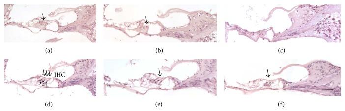 https://cdn.ncbi.nlm.nih.gov/pmc/blobs/79b9/4407513/a6a2154cf415/BMRI2015-934158.003.jpg