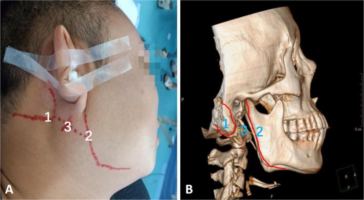 https://cdn.ncbi.nlm.nih.gov/pmc/blobs/79bb/11634690/80183bcb758e/fneur-15-1453598-g001.jpg