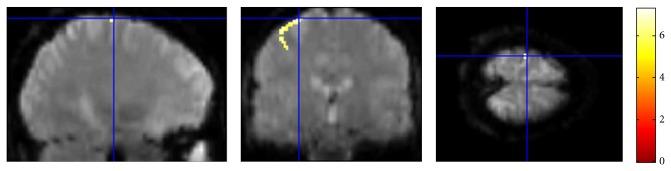 https://cdn.ncbi.nlm.nih.gov/pmc/blobs/79c1/4321086/101800e69b4c/CMMM2015-389875.005.jpg