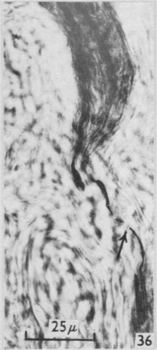 https://cdn.ncbi.nlm.nih.gov/pmc/blobs/79c3/1244142/2b992b58c47e/janat00431-0089-g.jpg