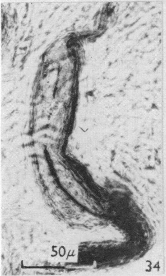 https://cdn.ncbi.nlm.nih.gov/pmc/blobs/79c3/1244142/47910e4d6f72/janat00431-0089-e.jpg