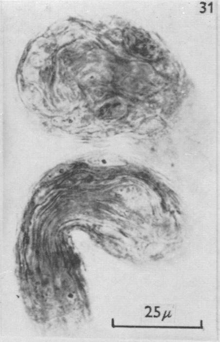 https://cdn.ncbi.nlm.nih.gov/pmc/blobs/79c3/1244142/5e2490eabf98/janat00431-0089-b.jpg