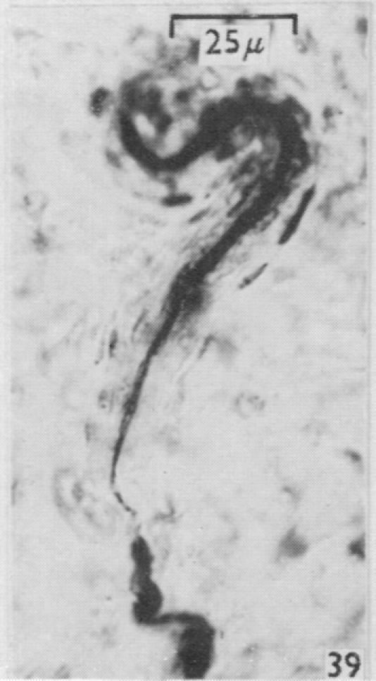https://cdn.ncbi.nlm.nih.gov/pmc/blobs/79c3/1244142/5f88ea17e00d/janat00431-0089-j.jpg