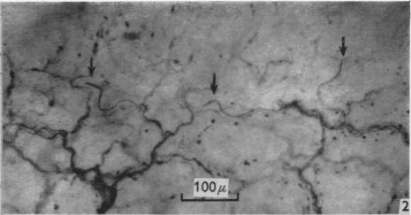 https://cdn.ncbi.nlm.nih.gov/pmc/blobs/79c3/1244142/871c7e2c66b2/janat00431-0087-b.jpg