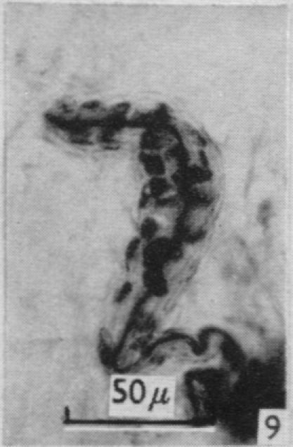 https://cdn.ncbi.nlm.nih.gov/pmc/blobs/79c3/1244142/9a994fc534c5/janat00431-0087-i.jpg