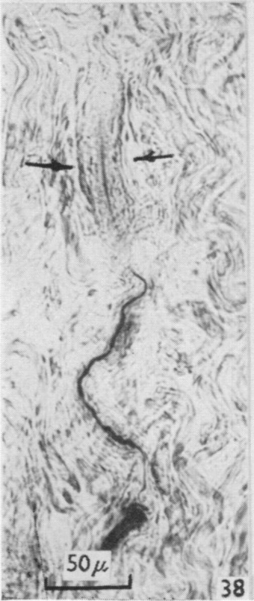 https://cdn.ncbi.nlm.nih.gov/pmc/blobs/79c3/1244142/b03d3d8a68fc/janat00431-0089-i.jpg