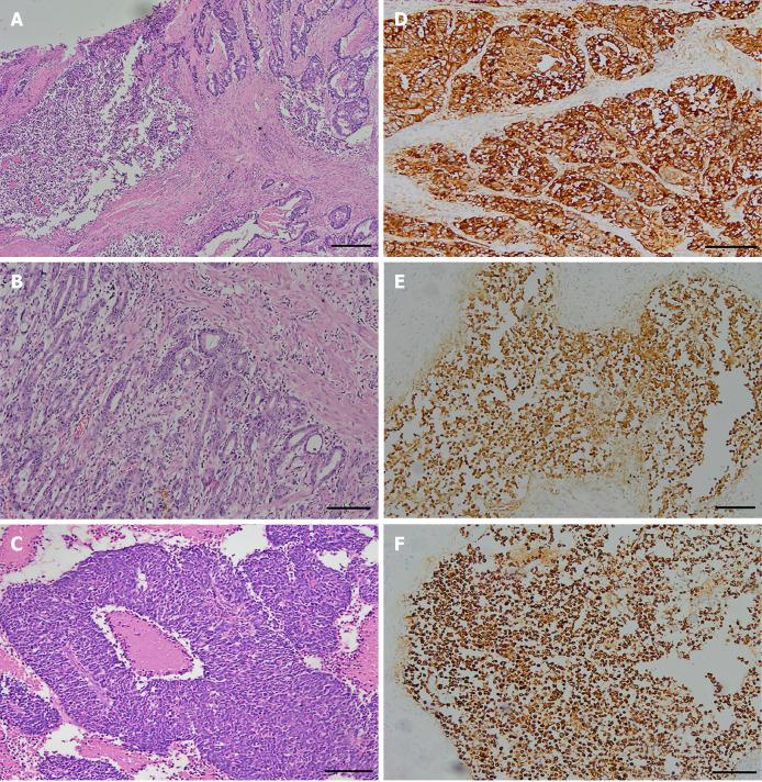 https://cdn.ncbi.nlm.nih.gov/pmc/blobs/79c4/7901054/f1d4d6720771/WJG-27-624-g001.jpg