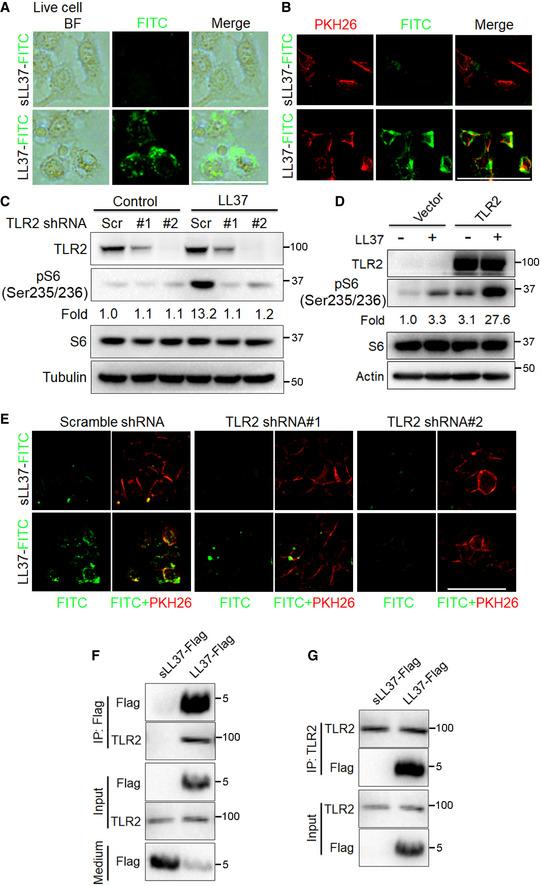 https://cdn.ncbi.nlm.nih.gov/pmc/blobs/79c7/8103105/5d133173fdd3/EMMM-13-e13560-g006.jpg