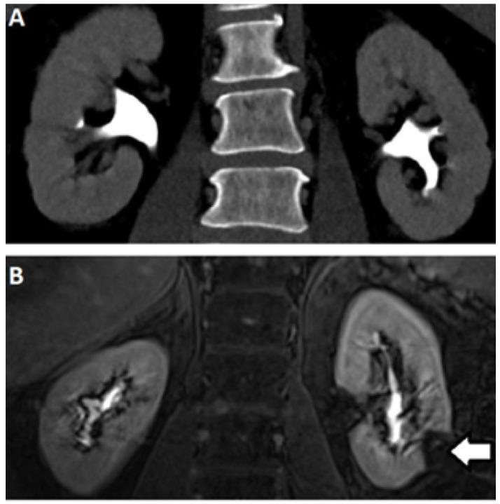https://cdn.ncbi.nlm.nih.gov/pmc/blobs/79c8/8103243/6318c5a6b19e/tomography-07-00008-g004.jpg