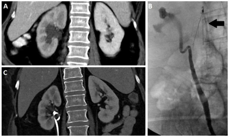 https://cdn.ncbi.nlm.nih.gov/pmc/blobs/79c8/8103243/a704018bc4d8/tomography-07-00008-g001.jpg