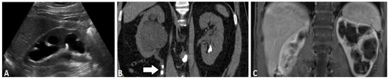 https://cdn.ncbi.nlm.nih.gov/pmc/blobs/79c8/8103243/ce5f5a501b73/tomography-07-00008-g002.jpg