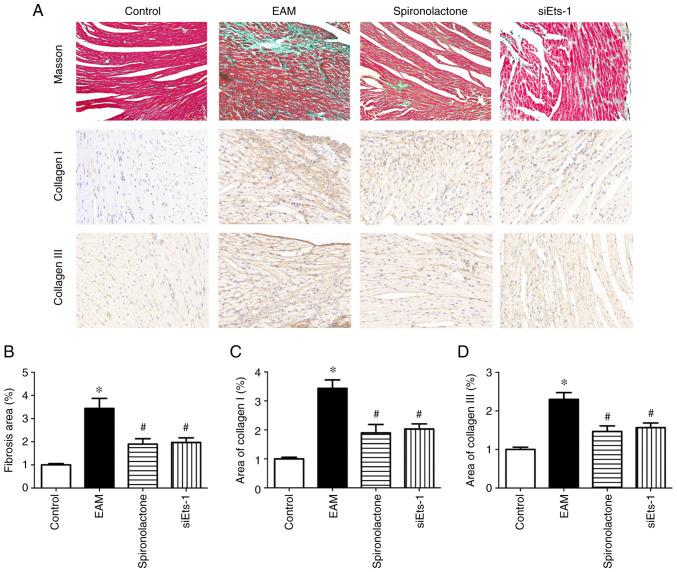 https://cdn.ncbi.nlm.nih.gov/pmc/blobs/79c9/9019666/6847c4e3ef5d/etm-23-06-11296-g04.jpg