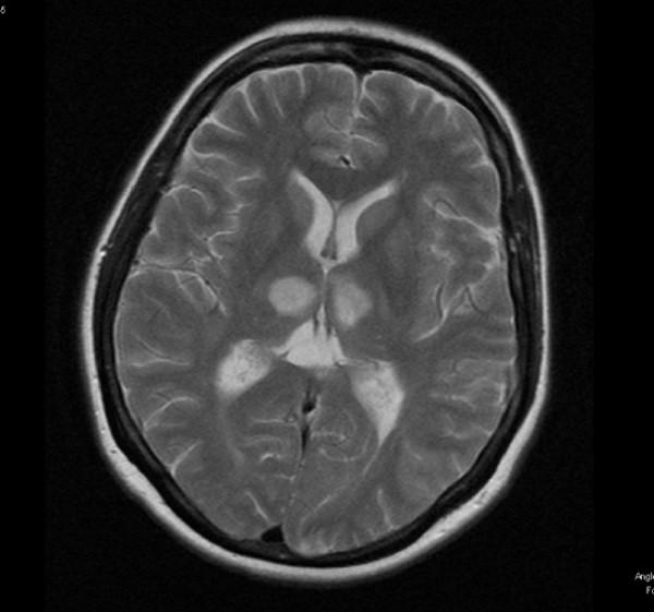 https://cdn.ncbi.nlm.nih.gov/pmc/blobs/79cd/2278152/651db41b25d6/1752-1947-2-75-1.jpg