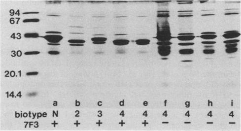 https://cdn.ncbi.nlm.nih.gov/pmc/blobs/79d2/257109/ff2c3d7a3a68/iai00029-0305-a.jpg