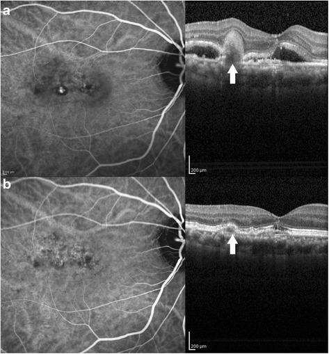 https://cdn.ncbi.nlm.nih.gov/pmc/blobs/79d3/4964097/efdbd71ed429/12886_2016_305_Fig1_HTML.jpg
