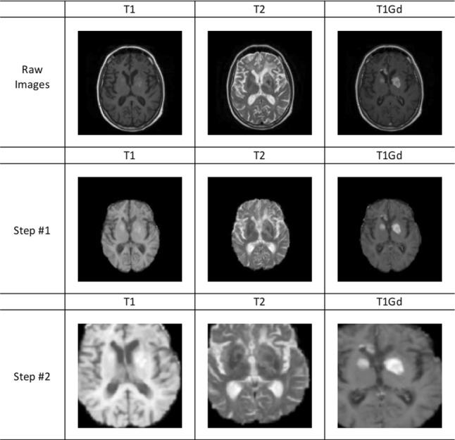 https://cdn.ncbi.nlm.nih.gov/pmc/blobs/79d7/10497660/ef51cea794df/11548_2023_2886_Fig1_HTML.jpg