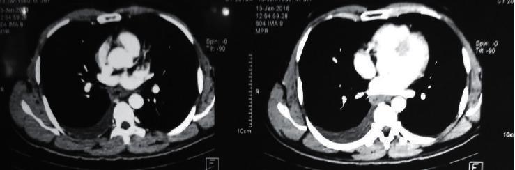 https://cdn.ncbi.nlm.nih.gov/pmc/blobs/79d7/7450306/c34371faf042/CRIM2020-1745834.001.jpg