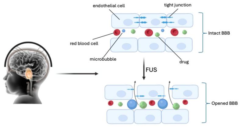 https://cdn.ncbi.nlm.nih.gov/pmc/blobs/79d8/12030708/ec3d1ccff0d6/pharmaceuticals-18-00525-g002.jpg