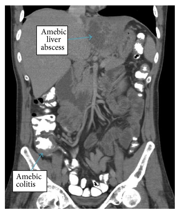 https://cdn.ncbi.nlm.nih.gov/pmc/blobs/79da/4534593/12ec8a949548/CRIID2015-516974.003.jpg