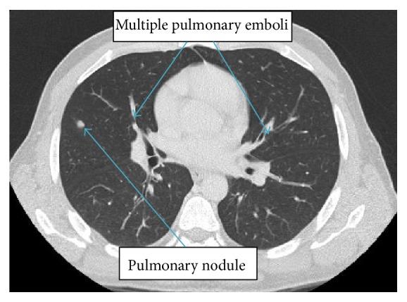 https://cdn.ncbi.nlm.nih.gov/pmc/blobs/79da/4534593/dbc46cef8a2b/CRIID2015-516974.001.jpg