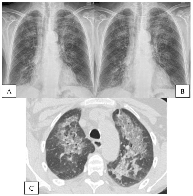 https://cdn.ncbi.nlm.nih.gov/pmc/blobs/79da/9696632/764ef4f98ff0/jof-08-01167-g001.jpg