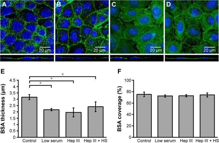 https://cdn.ncbi.nlm.nih.gov/pmc/blobs/79e0/4959595/3762e511c359/ijn-11-3305Fig2.jpg
