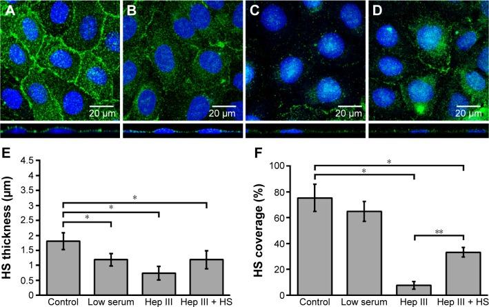 https://cdn.ncbi.nlm.nih.gov/pmc/blobs/79e0/4959595/ec027aa6e8aa/ijn-11-3305Fig3.jpg