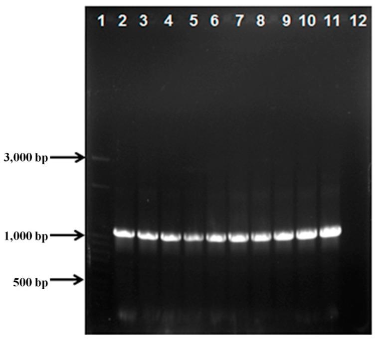 https://cdn.ncbi.nlm.nih.gov/pmc/blobs/79e9/7013543/1424e43a3bb5/ijms-21-00416-g002.jpg