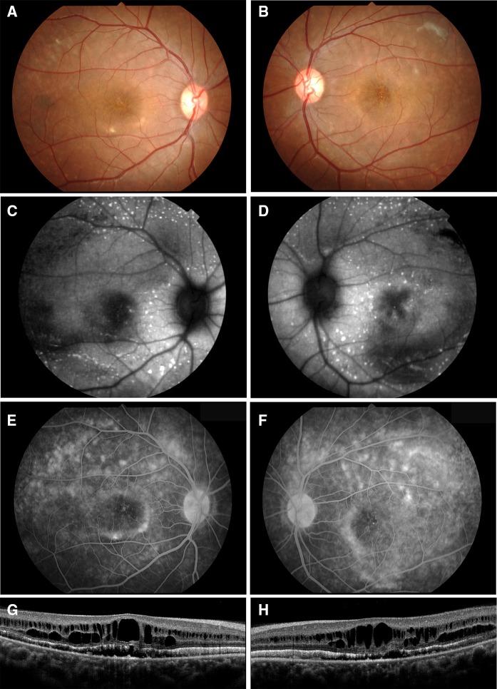 https://cdn.ncbi.nlm.nih.gov/pmc/blobs/79ea/4880638/d4c23b42273f/10633_2016_9540_Fig1_HTML.jpg