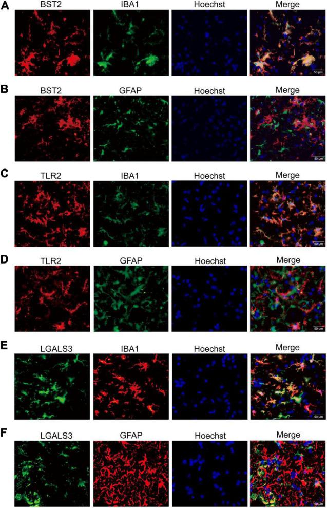 https://cdn.ncbi.nlm.nih.gov/pmc/blobs/79eb/8858987/ee9c97473c7e/fnins-15-788730-g004.jpg