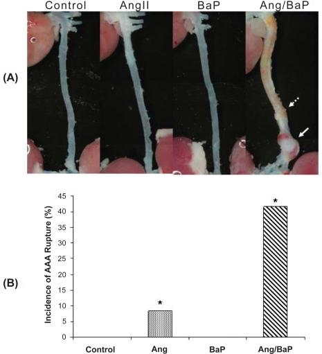 https://cdn.ncbi.nlm.nih.gov/pmc/blobs/79ed/2605340/131831326a1b/vhrm-4-1095f2.jpg