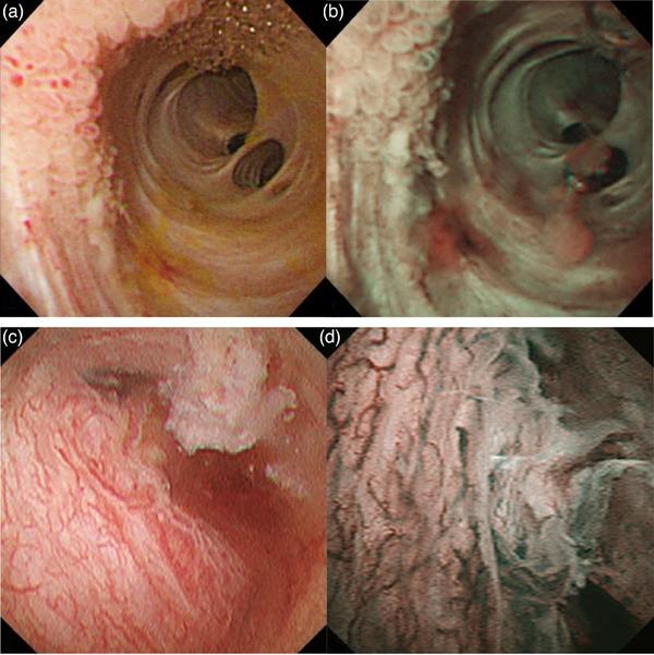 https://cdn.ncbi.nlm.nih.gov/pmc/blobs/79f2/11091847/5270cd97fbeb/DEO2-5-e382-g017.jpg
