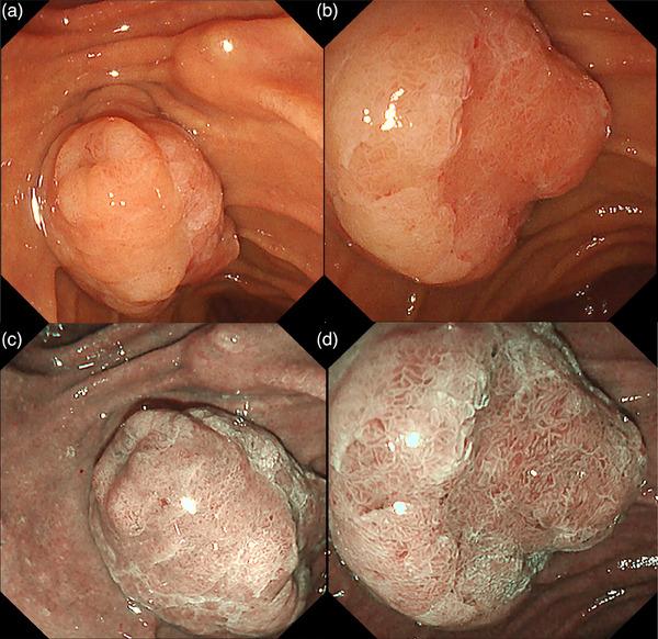 https://cdn.ncbi.nlm.nih.gov/pmc/blobs/79f2/11091847/81fb0195468f/DEO2-5-e382-g011.jpg