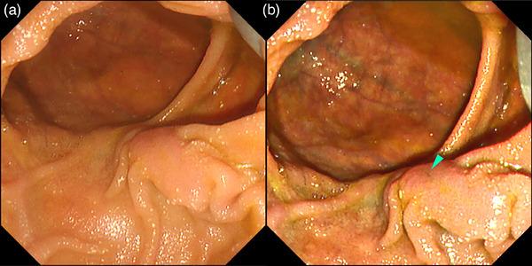 https://cdn.ncbi.nlm.nih.gov/pmc/blobs/79f2/11091847/83f000a6096b/DEO2-5-e382-g016.jpg