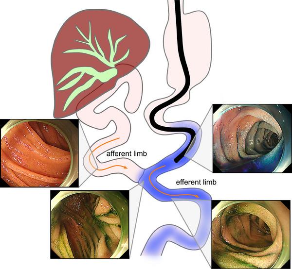 https://cdn.ncbi.nlm.nih.gov/pmc/blobs/79f2/11091847/99423f54199a/DEO2-5-e382-g001.jpg
