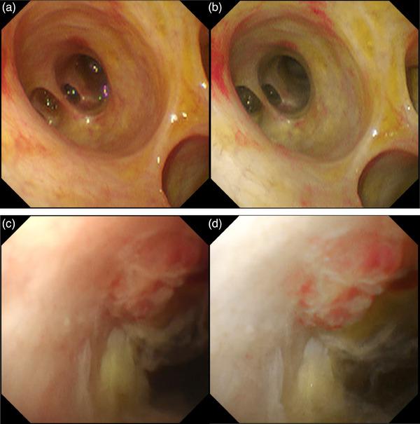 https://cdn.ncbi.nlm.nih.gov/pmc/blobs/79f2/11091847/c6195d49b72d/DEO2-5-e382-g010.jpg