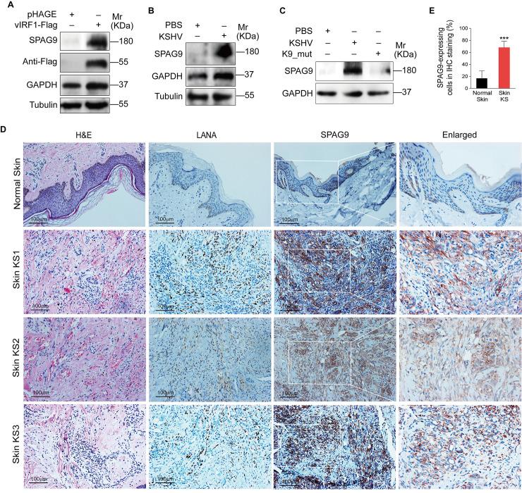 https://cdn.ncbi.nlm.nih.gov/pmc/blobs/79f4/7446834/c521b834026d/ppat.1008730.g001.jpg
