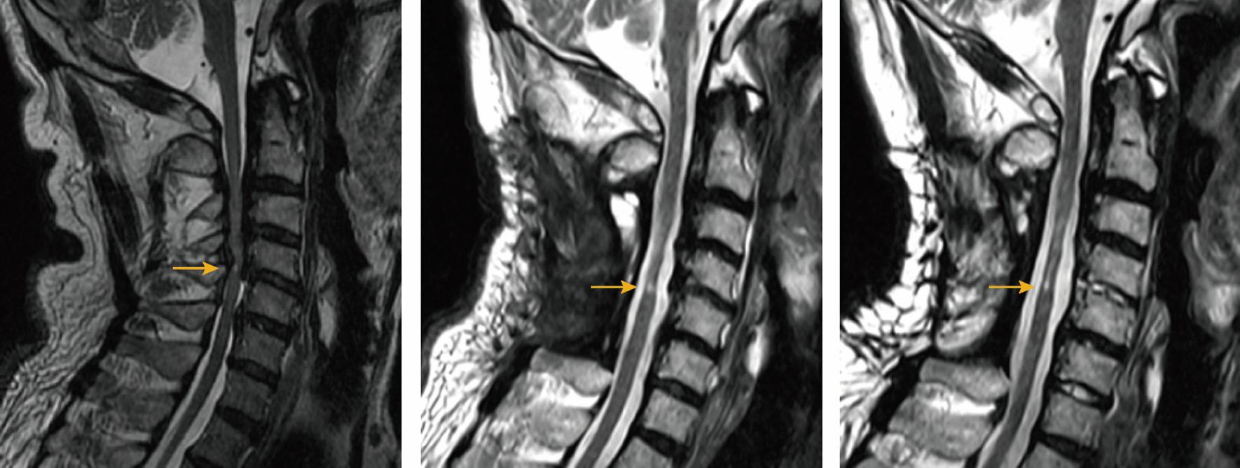 https://cdn.ncbi.nlm.nih.gov/pmc/blobs/79f5/10675957/3f81a13aea1d/13018_2023_4388_Fig5_HTML.jpg