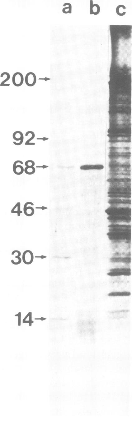 https://cdn.ncbi.nlm.nih.gov/pmc/blobs/79f9/555201/0762bf702392/emboj00259-0059-b.jpg