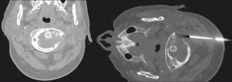 https://cdn.ncbi.nlm.nih.gov/pmc/blobs/79fe/8475163/08a69470cca8/rb-54-05-0295-g03.jpg