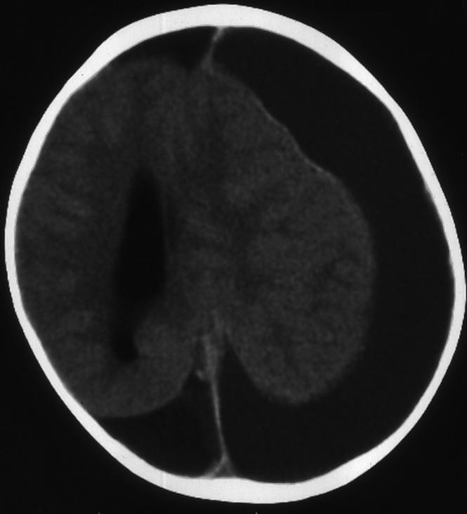 https://cdn.ncbi.nlm.nih.gov/pmc/blobs/7a00/3610458/93b82f7544a9/IJCCM-16-222-g001.jpg